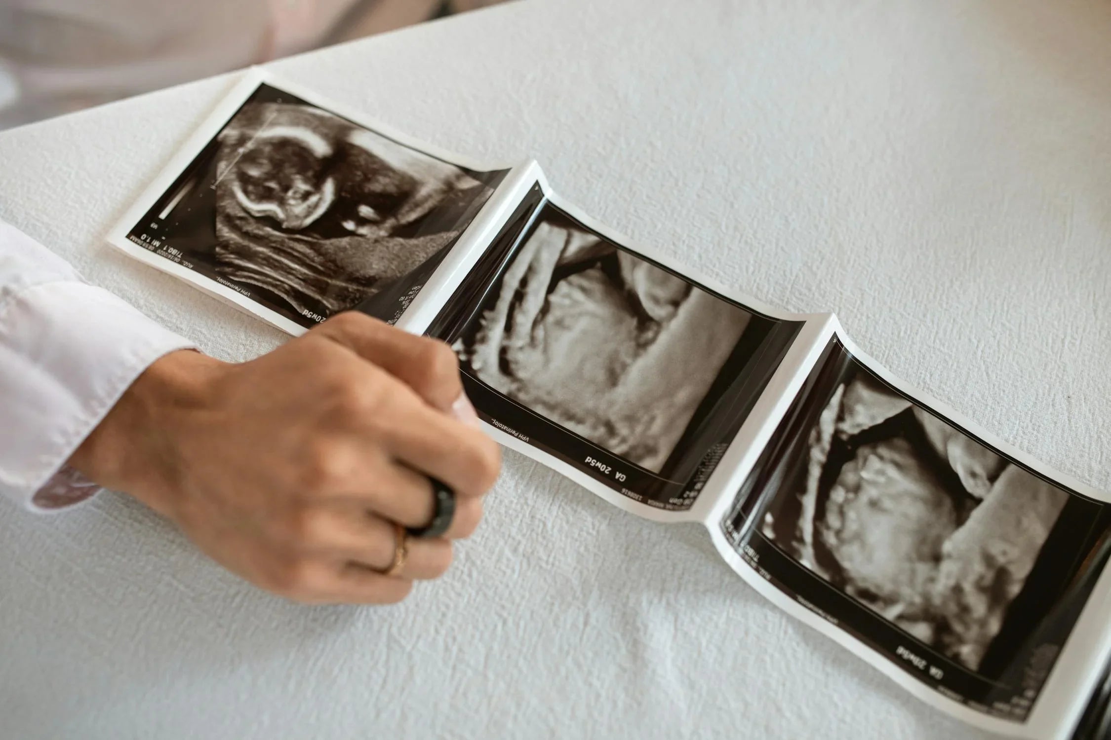 What Can Cause a False Positive Pregnancy Test: Key Reasons Explained