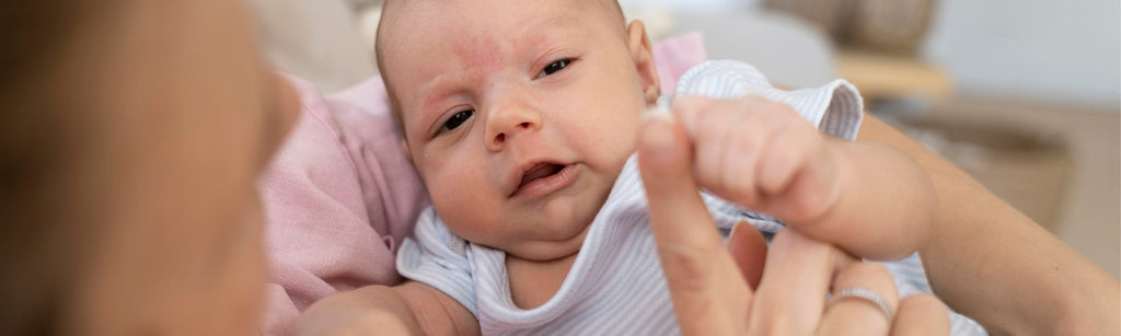 Does Breast Milk Help Baby Acne?