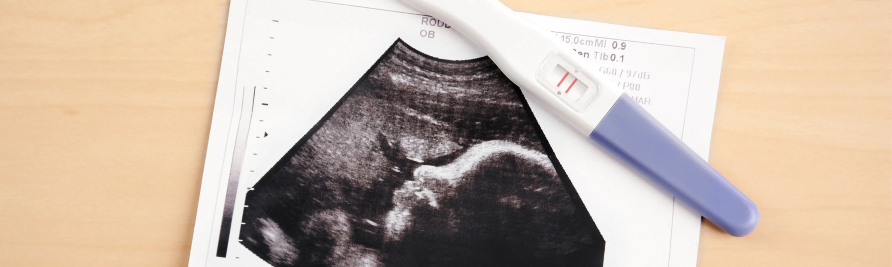 How Much Does a Pregnancy Test Cost? A Complete Guide