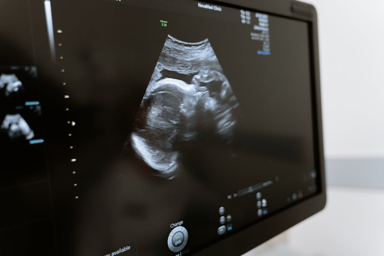 First Trimester | Nausea and Morning Sickness: Coping Strategies for the First Trimester