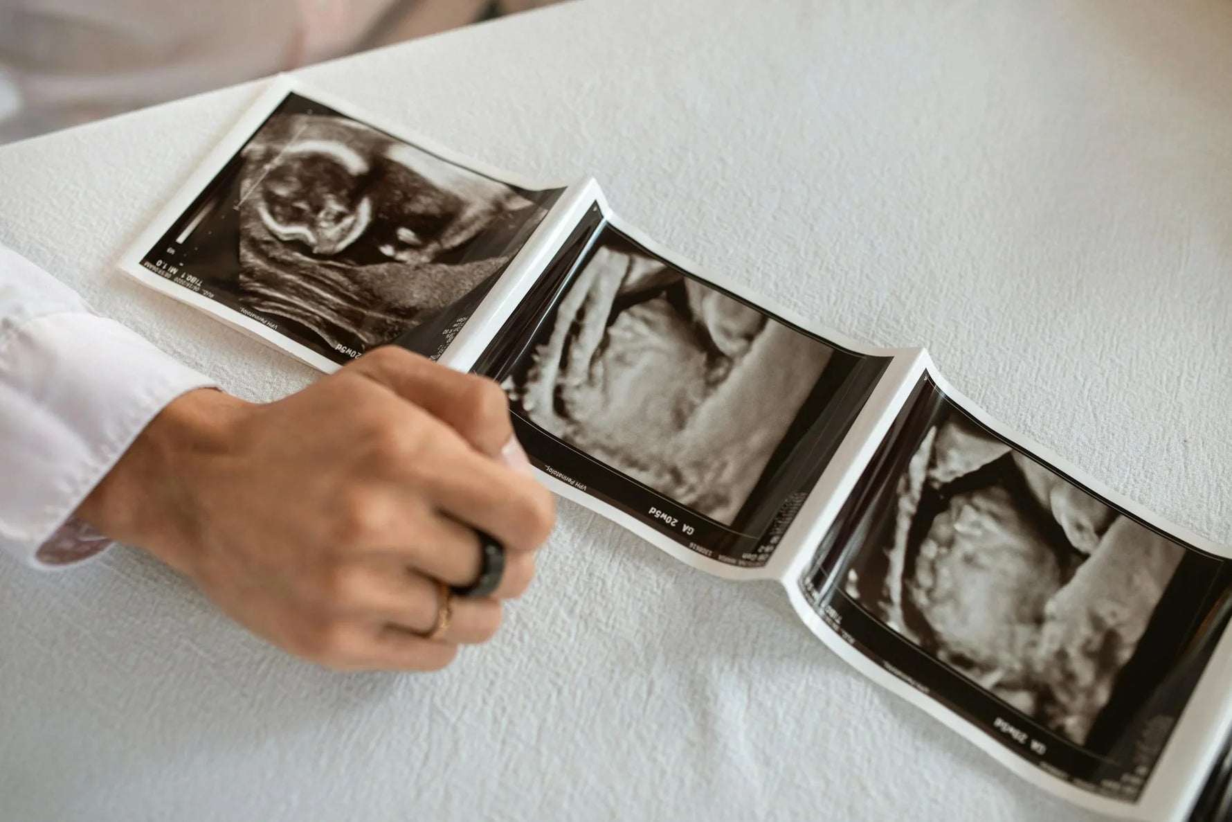What Can Cause a False Positive Pregnancy Test: Key Reasons Explained
